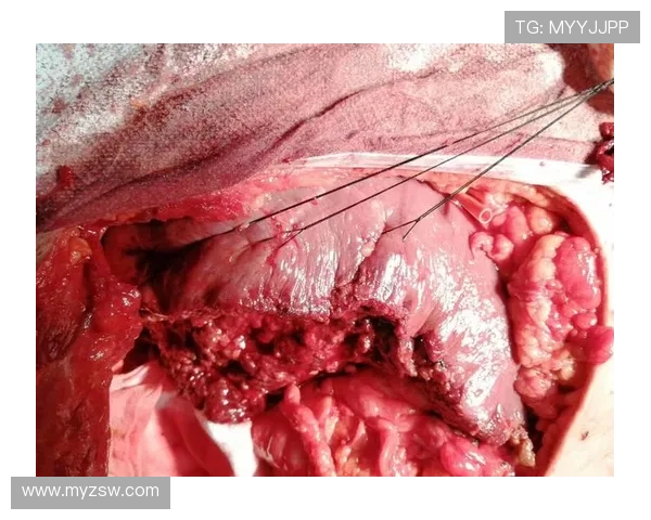 米利克肌肉伤势轻微预计顺利恢复